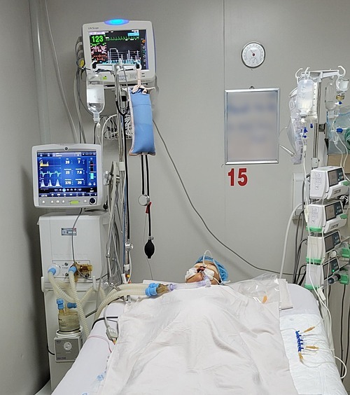 Một trường hợp sốt xuất huyết nặng người lớn đang điều trị tại Bệnh viện Bệnh Nhiệt đới. Ảnh: Bệnh viện cung cấp