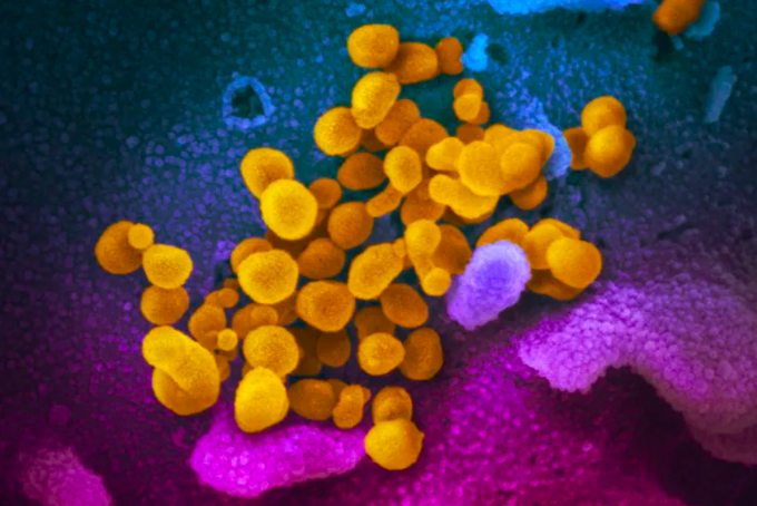nCoV (màu vàng) được nuôi cấy trong phòng thí nghiệm tại Viện Y tế Quốc gia Mỹ (NIH), năm 2020. Ảnh: NIH
