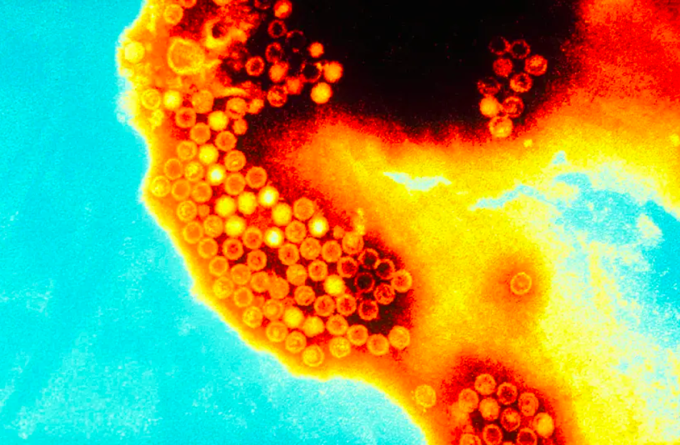 Virus viêm gan A gây viêm gan cấp tính, dạng phổ biến nhất của viêm gan do virus. Ảnh: Flickr