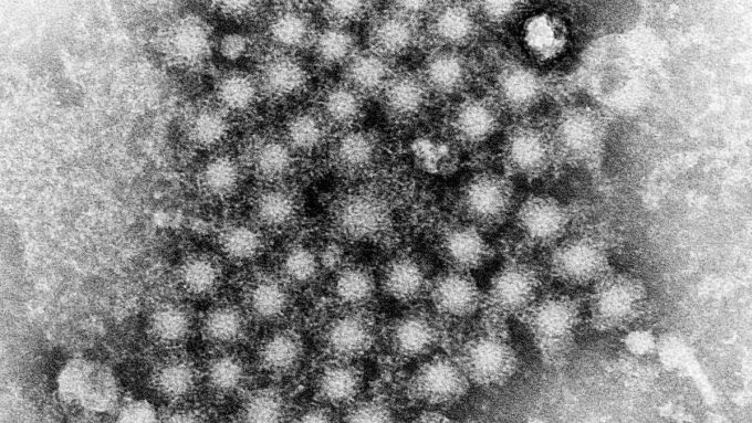 Hình ảnh hiển vi của các virus viêm gan chưa xác định. Ảnh: Sky News