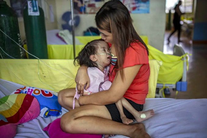 Một bệnh nhi sởi tại Philippines. Ảnh: NY Times