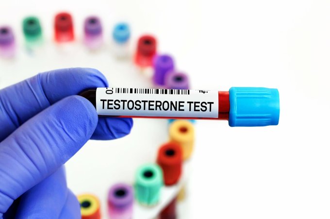 Nam giới được đánh giá sức khỏe tình dục qua việc kiểm tra nồng độ testosterone trong máu 2 lần vào 2 buổi sáng khác nhau. Ảnh: Shutterstock