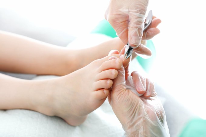 Thói quen lấy khóe móng khi làm nail có thể gây ra móng chọc thịt. Ảnh: Shutterstock