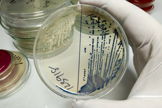 90% vi khuẩn gây nhiễm trùng đường tiểu là trực khuẩn lỵ E.Coli. Ảnh: Shutterstock