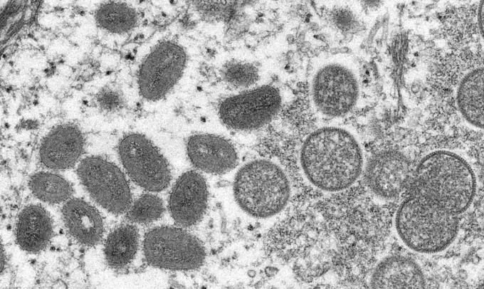 Virus đậu mùa khỉ dưới kính hiển vi. Ảnh: US CDC