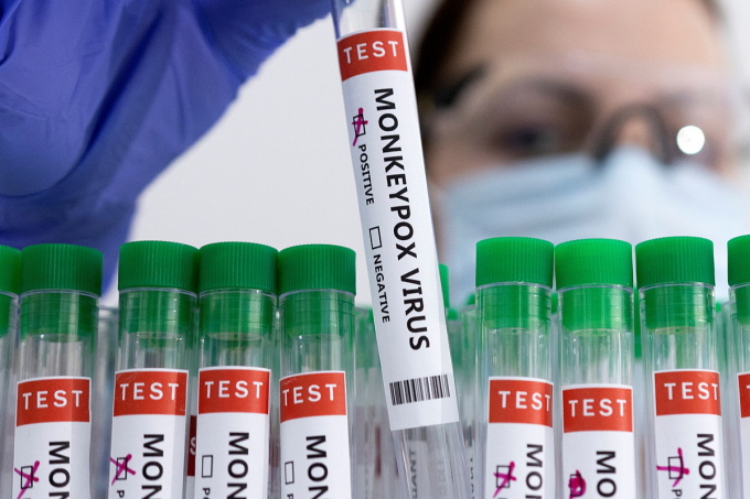Các ống nghiệm có nhãn dương tính với virus đậu mùa khỉ, ngày 23/5. Ảnh: Reuters