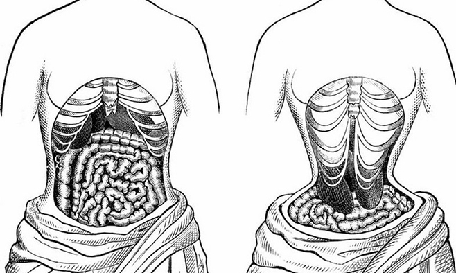 Hình ảnh cơ quan trong cơ thể biến đổi do dùng nịt bụng. Ảnh: Pulse