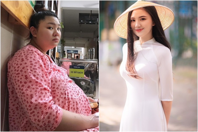 Lần đầu mang thai, Hồng Anh tăng thêm 36 kg, cân nặng lên bàn mổ là 96 kg. Sau một năm, cô giảm được 43 kg, cân nặng còn 53 kg. Ảnh: Nhân vật cung cấp