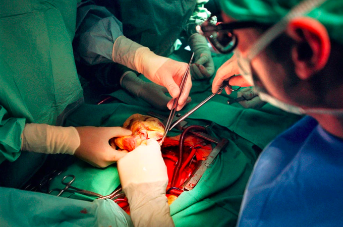 Bác sĩ thực hiện ca phẫu thuật ghép tim tại bệnh viện Inselspital ở Bern, Thụy Sĩ. Ảnh: Keystone