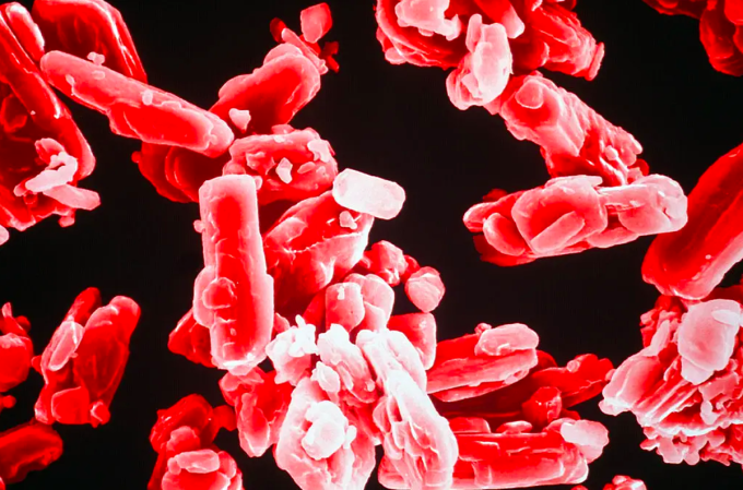Hình ảnh hiển vi điện tử của cholesterol trong cơ thể người. Ảnh: Science