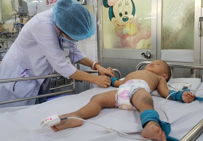 Trẻ mắc tay chân miệng điều trị tại Bệnh viện Nhi đồng 1. Ảnh: Lê Phương