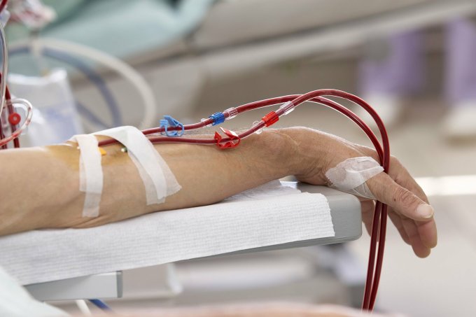 Người bệnh cần đến bệnh viện lọc máu khoảng 3 lần/tuần. Ảnh: Shutterstock