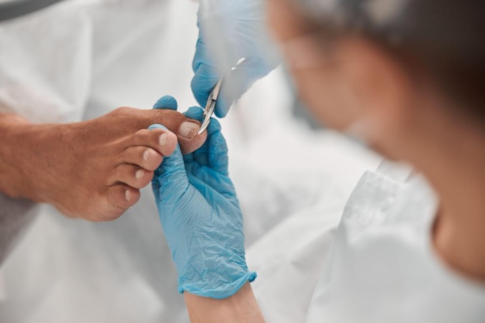 Bạn có thể nhờ nhân viên y tế cắn móng để đảm bảo an toàn cho bàn chân, tránh xây xước nhiễm trùng. Ảnh: Shutterstock