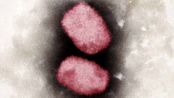 Ảnh hiển vi của virus đậu mùa khỉ. Ảnh: AFP