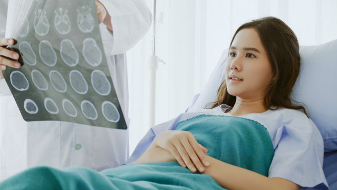 Chụp sọ não sau chấn thương giúp xác định tổn thương và điều trị kịp thời. Ảnh: Shutterstock