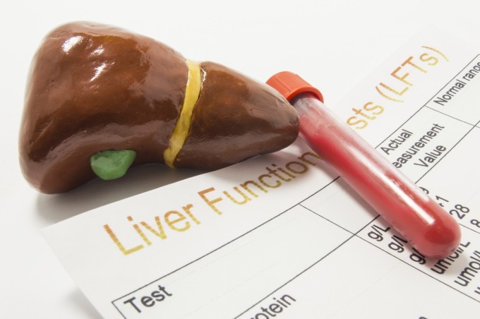 Tăng men gan là cảnh báo cho thấy tế bào gan đang viêm hoặc hoại tử. Ảnh: Shutterstock