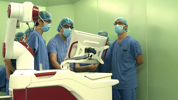 Robot Rosa phẫu thuật thần kinh trong một lần được sử dụng năm 2017. Ảnh:Bệnh viện Bạch Mai
