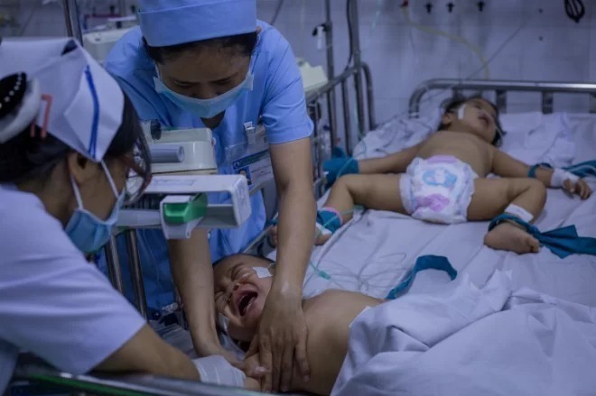 Trẻ mắc tay chân miệng nhập viện điều trị tại TP HCM. Ảnh: Thành Nguyễn