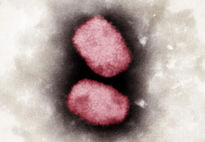 Hình ảnh hiển vi có màu của virus đậu mùa khỉ tại Viện Robert Koch. Ảnh: AFP