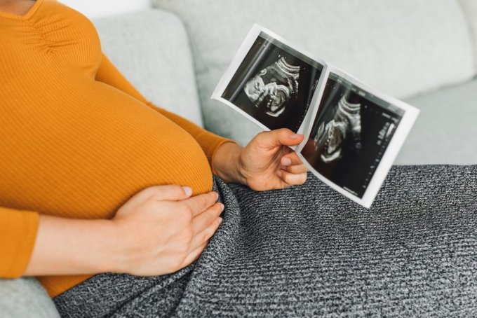 Xét nghiệm NIPT đánh giá nguy cơ thai nhi dị tật bẩm sinh, bệnh lý di truyền phổ biến. Ảnh: Shutterstock