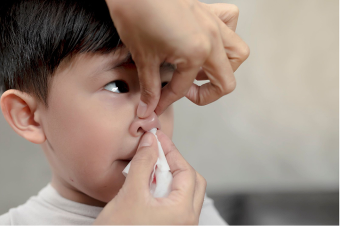 Nhét giấy vào mũi để cầm máu có thể khiến trẻ bị nhiễm trùng. Ảnh: Shutterstock