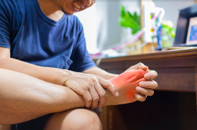 Bệnh gout nếu không được kiểm soát tốt có thể gây biến chứng lên thận hoặc thoái hóa khớp. Ảnh: Shutterstock