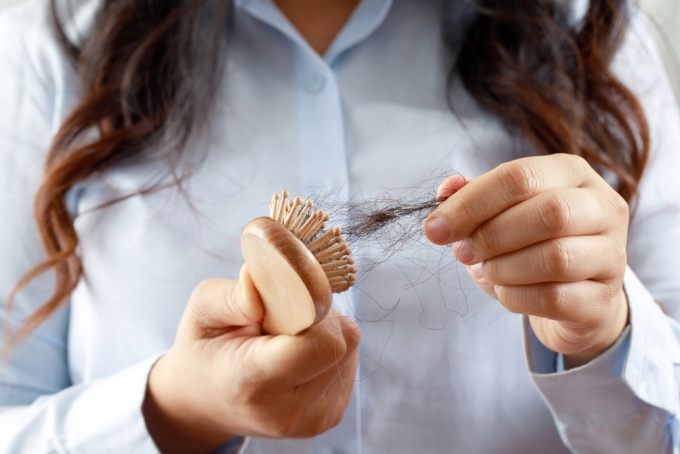 Nhịn ăn để giảm cân có thể gây rụng tóc. Ảnh: Shutterstock