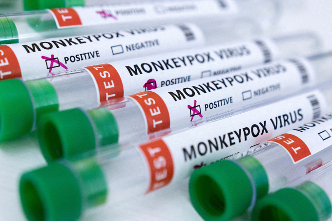 Các ống nghiệm có nhãn virus đậu mùa khỉ cho kết quả dương tính và âm tính. Ảnh: Reuters