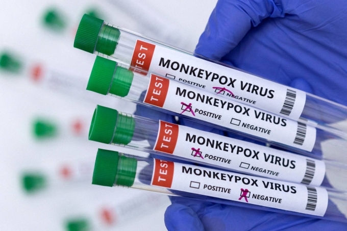 Các ống nghiệm dán nhãn virus đậu mùa khỉ được đánh dấu kết quả xét nghiệm dương tính và âm tính. Ảnh: Reuters