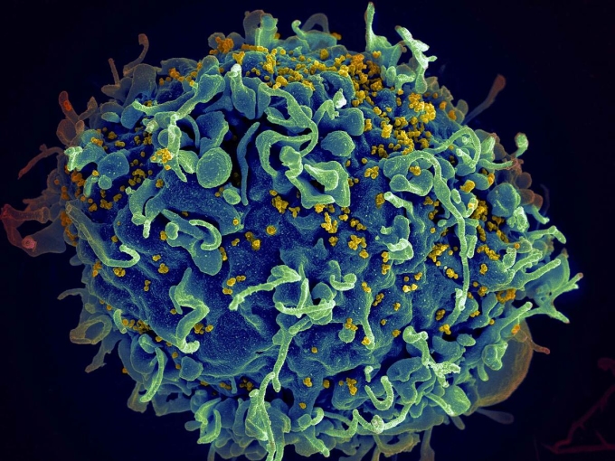 Tế bào người (màu xanh) bị virus HIV (màu vàng) tấn công. Ảnh: NIH
