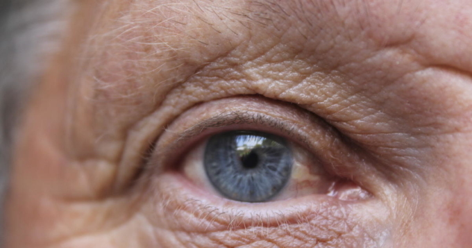 Các triệu chứng ở mắt khi thức dậy có thể báo hiệu đột quỵ. Ảnh: CBS