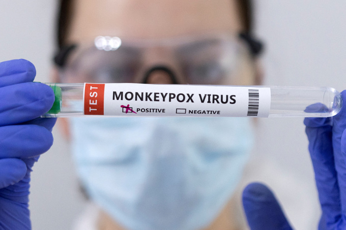 Nhân viên y tế cầm ống nghiệm chứa mẫu bệnh phẩm dương tính với virus đậu mùa khỉ. Ảnh: Reuters