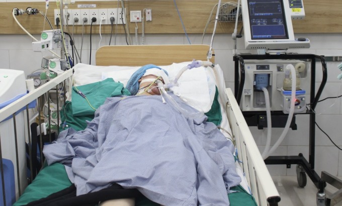 Bệnh nhân đang được theo dõi và chăm sóc tích cực tại Bệnh viện Bạch Mai, tình trạng nặng nề. Ảnh: Thùy Trang