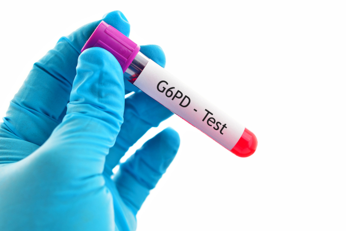 Xét nghiệm máu giúp phát hiện bệnh thiếu men G6PD ở trẻ sơ sinh. Ảnh: Shutterstock